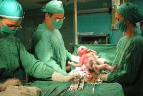 Mortalidad infantil en Cuba se mantiene por debajo de cinco